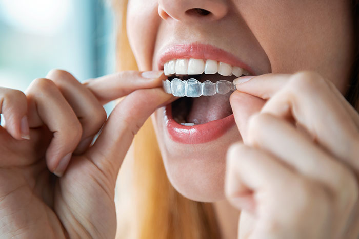 GeorgetownSleepDentistry-1226447065